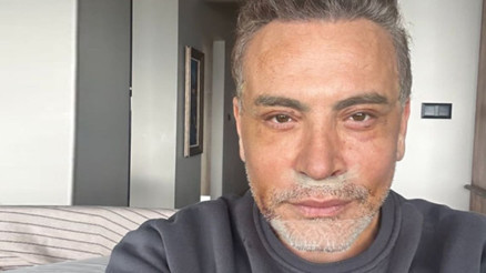 Estetik operasyon geçirmişti... Son halini paylaştı