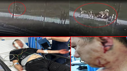 Oğlunu korumak isterken köpeklerin saldırısına uğramıştı... Dikkat çeken detay ortaya çıktı 2 ay pipetle beslenecek