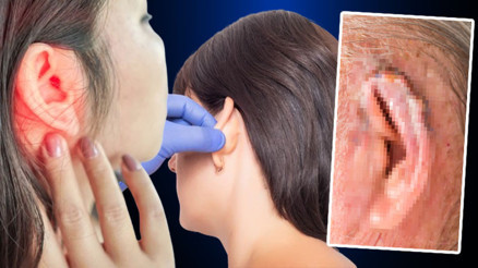 Sosyal medyada popüler oldu: Kepçe kulak bantları tehlike saçıyor ‘Öldürücü anafilaktik şok oluşabilir’