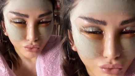 Estetik operasyonundan sonra ilk poz Hoş geldin yeni Selen