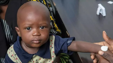 Gambia’da yürütülen mikro iğneli bant aşı testinin sonuçları başarılı