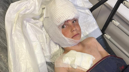 7 yaşındaki Bilale köpek saldırdı Babası isyan etti: Oğlum ölümden döndü