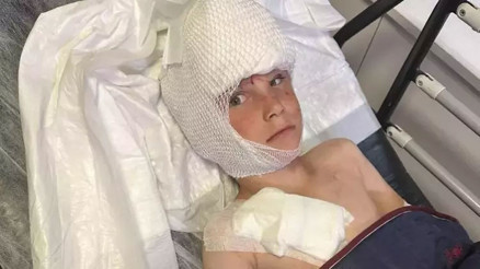 Köpeğin saldırdığı 7 yaşındaki Bilal, yaralandı