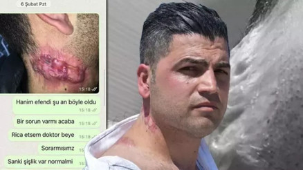 İzmirde lazer tedavisi sonrası yanık izi belirginleşti iddiası