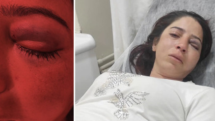 Eşinden şiddet gördüğü için evden kaçtı... Kardeşi de sopayla dövdü