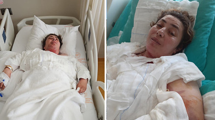 46 yaşındaki kadın mutfakta kâbusu yaşadı Bomba gibi patladı... Yüzüme gelse kurtulamazdım