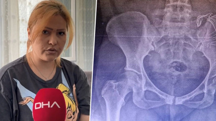 Doğumda vücudunda unutulan gazlı bez unutuldu 10 ay sonra fark edildi... Ölümden döndüm