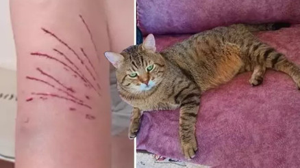 Besledikleri kedinin saldırısına uğrayan 2 kişi hastanelik oldu