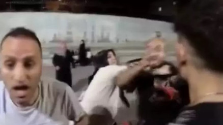 Arnavutköy’de bisiklet parkurundaki çocuğa saldırı Arnavutköy’de bisiklet parkurundaki çocuğa saldırı