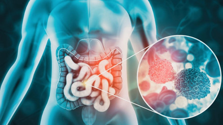 Her gün 100 gence teşhis konuyor... Bu hastalık artık her yaşta çok sık görülüyor