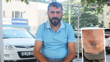 Tanıştığı kişinin tedavi sözüne inandı, hayatı kâbusa döndü Bacağımın her yeri patladı... 2 aydır çalışamıyorum Tanıştığı kişinin tedavi sözüne inandı, hayatı kâbusa döndü Bacağımın her yeri patladı... 2 aydır çalışamıyorum
