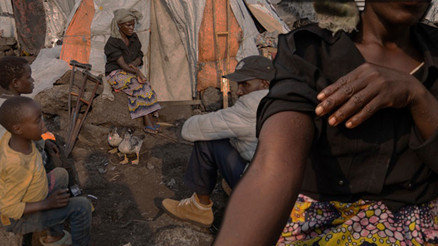 M çiçeği virüsü yayılıyor... Avrupadan sonra Asyadan da ilk vaka haberi geldi...