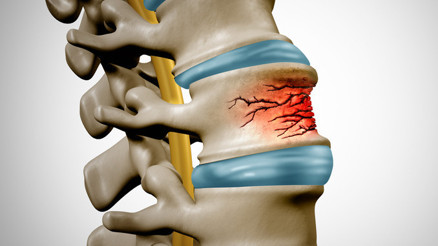 Bilim insanları kemik kütlesini iki katına çıkarabilen yeni bir hormon keşfetti Bilim insanları kemik kütlesini iki katına çıkarabilen yeni bir hormon keşfetti