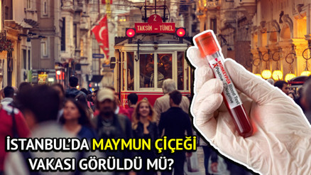 İstanbulda Maymun çiçeği görüldü mü, var mı İstanbul İl Sağlık Müdürlüğü açıklama yaptı