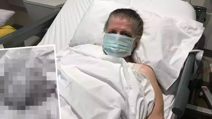 Göğsünden boynuna kadar uzanan 7 kiloluk kitleyi taşıyan Özcan’ın tümörü temizlendi Göğsünden boynuna kadar uzanan 7 kiloluk kitleyi taşıyan Özcan’ın tümörü temizlendi