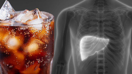 O kadar çok gazlı içecek tüketti ki en sonunda karaciğer nakli olmak zorunda kaldı… Üstelik alkol almıyordu, obez değildi ve spor yapıyordu ‘Benim gibi uyarı işaretlerini sakın görmezden gelmeyin’ O kadar çok gazlı içecek tüketti ki en sonunda karaciğer nakli olmak zorunda kaldı… Üstelik alkol almıyordu, obez değildi ve spor yapıyordu ‘Benim gibi uyarı işaretlerini sakın görmezden gelmeyin’