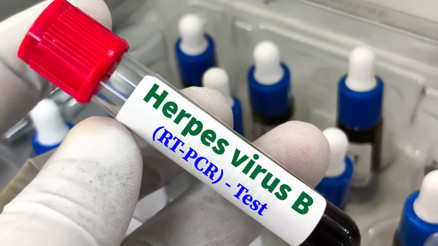 Otizmle bağlantılı dört virüs