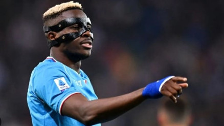 Osimhen neden maske takıyor Yüzünde tam 18 vida ve 6 plaka ile oynuyor...İşte, sebebi..