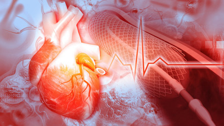 Her 2,5 dakikada bir kişi kalp ve damar hastalığı nedeniyle hayatını kaybediyor... Halbuki önlemek çok kolay Her 2,5 dakikada bir kişi kalp ve damar hastalığı nedeniyle hayatını kaybediyor... Halbuki önlemek çok kolay