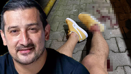 SERHAT AKIN SAĞLIK DURUMU SON DAKİKA | Silahlı saldırıya uğradı Serhat Akın vurulma anı... Fenerbahçenin eski futbolcusu Serhat Akın kimdir, kaç yaşında, nereli