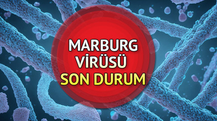 Marburg virüsü belirtileri nelerdir, nasıl anlaşılır Marburg virüsü nedir Aşılama kampanyası başlatıldı Marburg virüsü Türkiyede var mı 2024 İşte Marburg tedavisi hakkında bilgiler