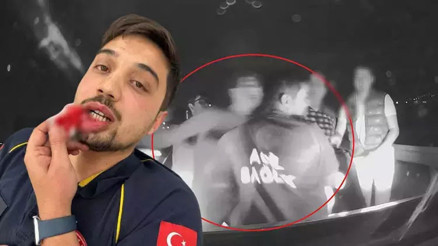 Baba ile oğlunun saldırısına uğrayan paramedik ambulans sürücüsü, olay anını DHA’ya anlattı