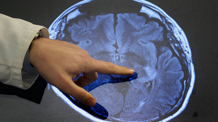 Deneme başarılı oldu: Kanserle savaşta olağanüstü tedavi Deneme başarılı oldu: Kanserle savaşta olağanüstü tedavi