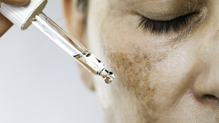 Yaşlılık (Güneş) lekelerini gidermek için etkili 3 besin