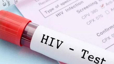 AIDS/HIV nedir, belirtileri nelerdir AIDS hastalığı nasıl bulaşır, neden olur, tedavisi var mı AIDS bulaşma yolları ve korunma yöntemleri