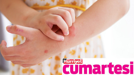 Alerji geliyorum demez