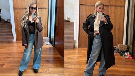 Estetik tutkusu kötü bitti: Artık gülemiyorum bile... Estetik tutkusu kötü bitti: Artık gülemiyorum bile...