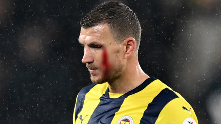 Maç sonu pişman oldu, Dzekodan özür diledi