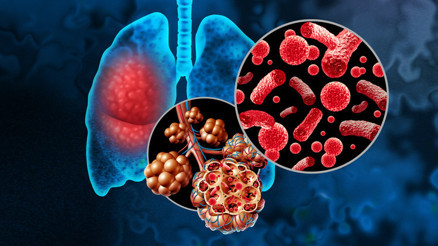 Dünyada en sık görülen, en fazla ölüme yol açan enfeksiyon... Kimler risk altında