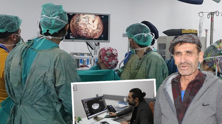 65 yaşındaki adamın kâbusu olmuştu... Doktorlar gözlerine inanamadı | Hamile bir kadının karnı gibiydi