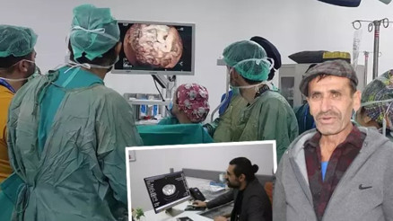 Yemekten sonra karnı şişip kusuyordu, 10 kattan fazla büyüyen midesi herkesi şaşırttı