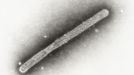 Kuş gribi yeniden hortladı: İlk ölüm gerçekleşti... ABDli yetkililer mutasyon bildirdi Kuş gribi yeniden hortladı: İlk ölüm gerçekleşti... ABDli yetkililer mutasyon bildirdi