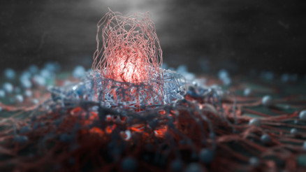 Erken evrede belirti vermiyor 21 yaşından itibaren bu testi mutlaka yaptırmalı