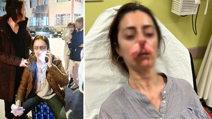 Edirnede başkasına benzettiği kadına dehşeti yaşattı