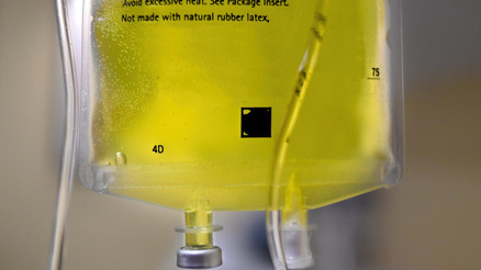 SARI SERUM TEHLİKESİ | ‘Ben yaptırıyorum bir şey olmadı’ demeyin 10 kez yaptırırsınız bir şey olmaz 11inci kez sizi canınızdan edebilir