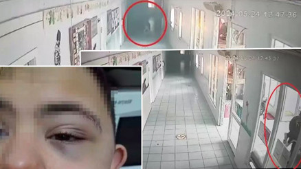 Down sendromlu öğrenciyi döven öğretmenin cezası belli oldu Mahkeme takdir indirimi uyguladı