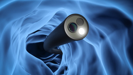 Endoskopi riskli bir işlem mi Bağırsak veya midede oluşan delinmeyi erkenden fark etmek hayati önem taşıyor