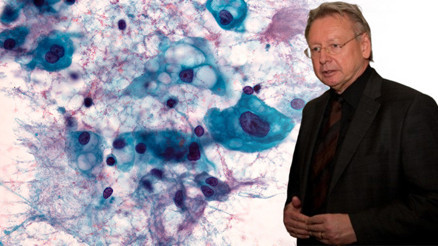 Annesi milyonda bir görülen ve tedavisi olmayan bir kanser nedeniyle ölmüştü... 36 yıl sonra çığır açan bir keşfe imza attı Kordomayı alt etmeye 5 yıl kaldı Annesi milyonda bir görülen ve tedavisi olmayan bir kanser nedeniyle ölmüştü... 36 yıl sonra çığır açan bir keşfe imza attı Kordomayı alt etmeye 5 yıl kaldı