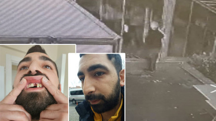 Gittiği pilavcıda, kapıyı açık unuttuğu için 6 kişi tarafından öldüresiye dövüldü Dişleri döküldü Gittiği pilavcıda, kapıyı açık unuttuğu için 6 kişi tarafından öldüresiye dövüldü Dişleri döküldü