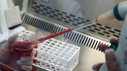 Bilinmeyen hastalık alarma geçirdi: Afrika ülkesinde çok sayıda ölü