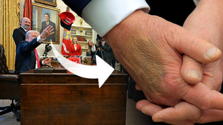 ABD Başkanı Donald Trumpın sağ elinin üzerindeki gizemli morluğun sebebi ne Cevabı Beyaz Saray verdi
