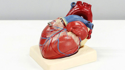 Erken teşhiste devrim Yetmezliği kalp değil, bacaklar söylüyor