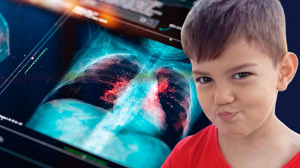 Vaka sayısı artmaya başladı: 5 yaşındaki Erdal’ı hayattan kopardı ‘Genelde hafife alınıyor ama ölüm oranları çoğaldı’ Vaka sayısı artmaya başladı: 5 yaşındaki Erdal’ı hayattan kopardı ‘Genelde hafife alınıyor ama ölüm oranları çoğaldı’