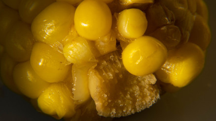 Bunları yemek karnınızı ağrıtıyorsa dikkat Nasıl tedavi ediliyor