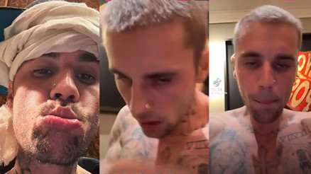 Ünlü şarkıcı yemeden içmeden kesildi… Artık uyumayı bile bıraktı: Kocam için dua edin