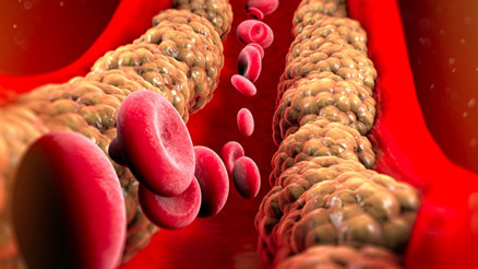 Adını duyunca öcü gibi korkuyoruz ama... Kolesterol zengini tüm gıdalar zararlı mı Yüksek kolesterol içeren hangi yiyeceklerden kaçınmalıyız